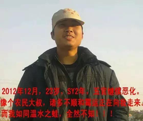 手淫3年，面貌早衰——戒手淫2年后改变！