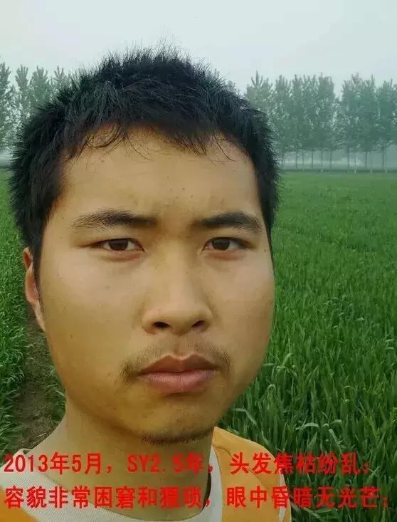 手淫3年，面貌早衰——戒手淫2年后改变！