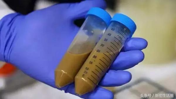 新密人看过来，来呀！一起去“粪斗”吧！啥也不用做，年入18万！