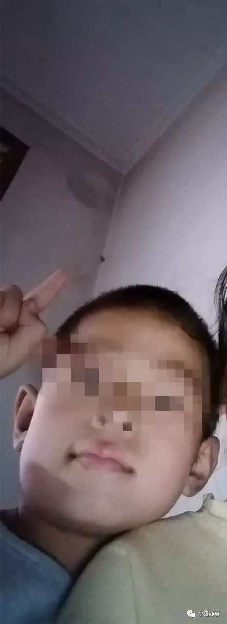 7岁男孩吃不下饭，不到一年瘦20斤+……请您支招儿！