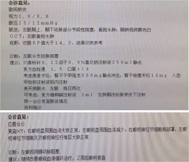 颈内动脉c5到c7段狭窄微创手术,天坛医院住院日记