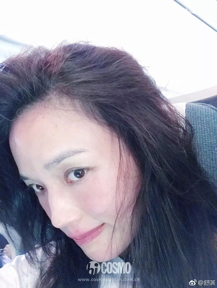 舒淇皮肤过敏,舒淇过敏脸是怎么好的