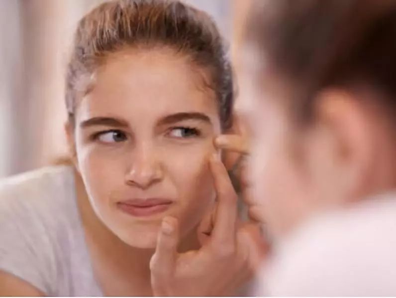 青春痘疤痕消除的药膏,青春痘疤痕图