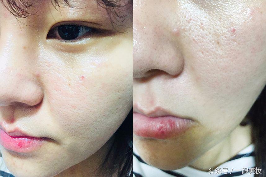 drje面膜真实测评,drjart面膜的正确使用方法