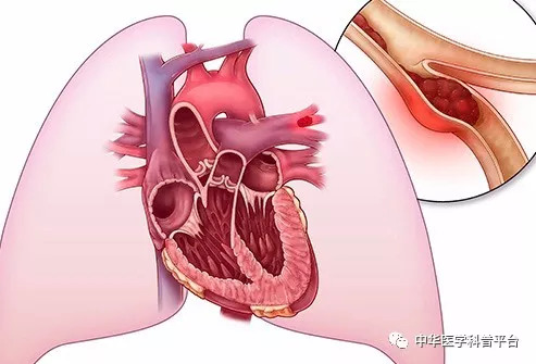 你需要知道的睡眠知识,医生告诉你血栓那些事