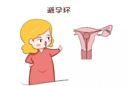 取环后多久可以备孕要孩子,取环后多久怀孕是最佳时期