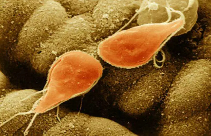 隐形眼镜冷知识杂烩 (一个有关隐形眼镜的问题)