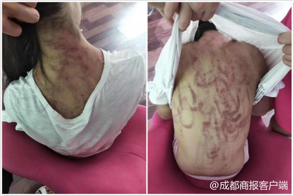 女童被继母虐打,女童遭继母虐打死后续