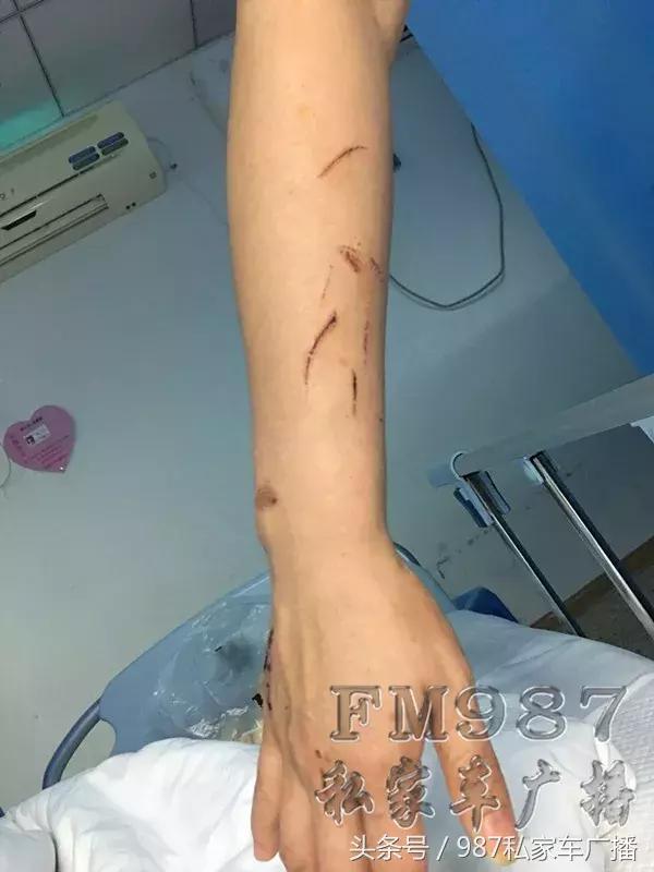 合肥滴滴顺风车事故拒赔 (福州滴滴网约车凌晨两点发生事故)