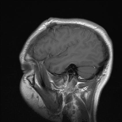 怎么劝导一个总怀疑自己有病的人,不承认自己有病是什么心理