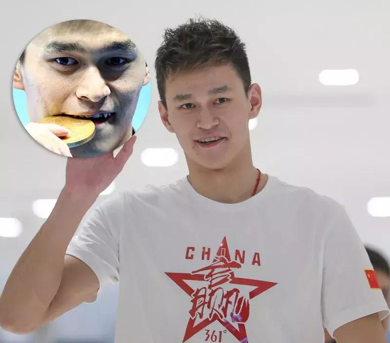 整牙后颜值明显变化的明星,明星真的会因为整牙而变漂亮了吗