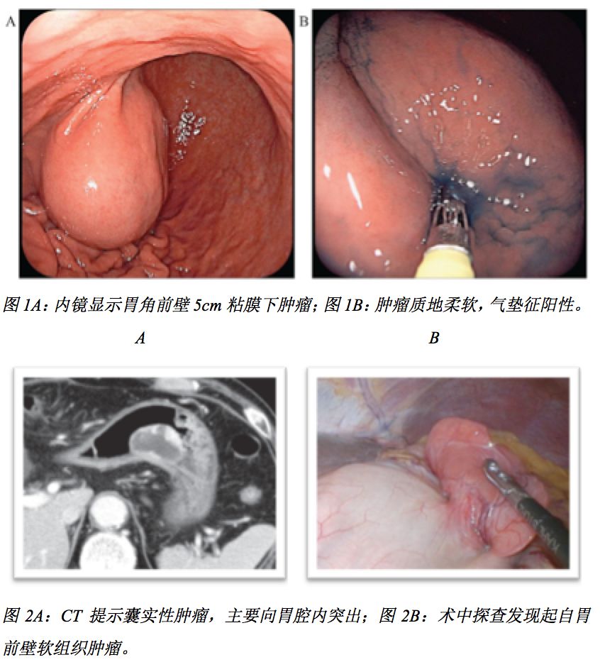 pubmed文献全文,pubmed文献可视化分析