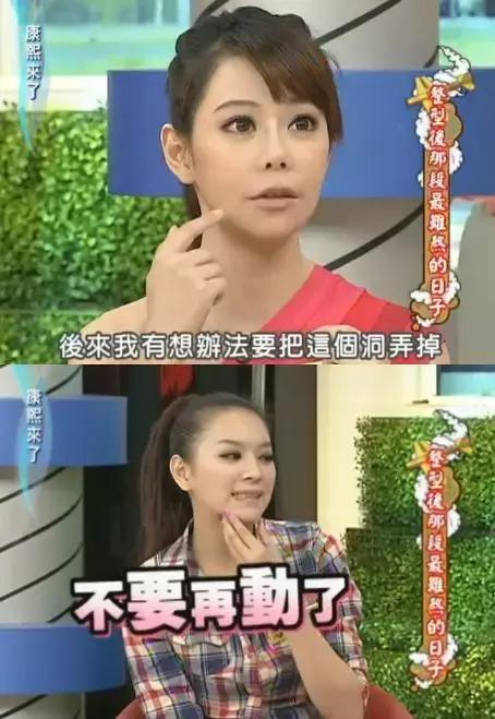 花百万整形60多次被嘲青蛙脸，这个台湾女主持真豁得出去