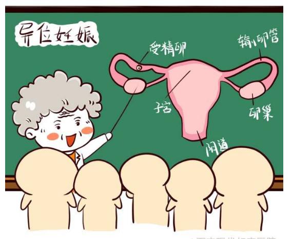 宫外孕大出血有多严重,宫外孕危险什么程度