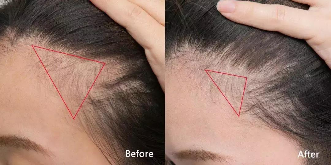 英国小贝夫妇现在怎么样了,小贝当年被英格兰抛弃