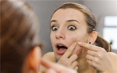 痘疮怎么才能快速治好,别让脸上的痘痘害了孩子一生