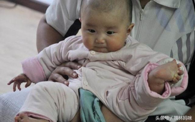 宝宝腹泻的原因及解决方法,宝宝腹泻都有哪些原因导致的