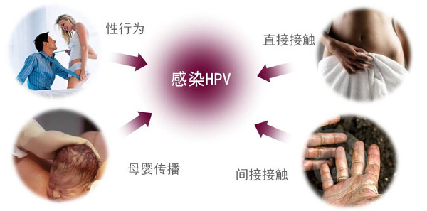 女性的噩梦——HPV感染原因有哪些？宫颈癌真的无法医治吗？