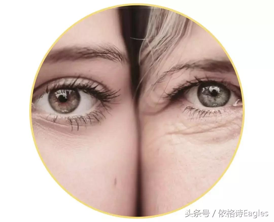 黑眼圈色素沉淀还有救吗,细纹黑眼圈用什么眼霜