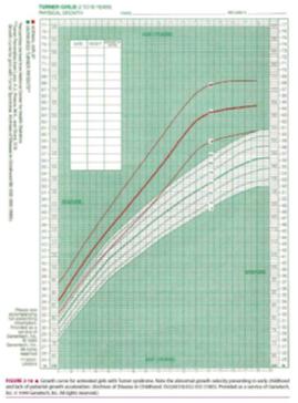 怎么规避turner综合征,turner综合征吃什么