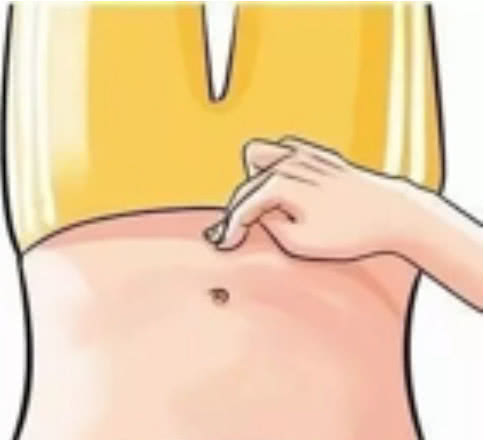 为什么孕妇会出现单脐动脉,孕妇为什么会是悬垂腹呢