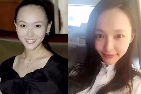 修理发际线男士,男生要不要修发际线