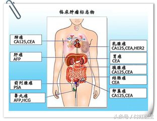 2cm的囊肿会导致痛经么,痛经一次比一次厉害怎么回事