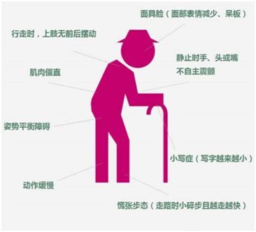 「新闻报」环渤海半岛帕金森病联盟正式成立~