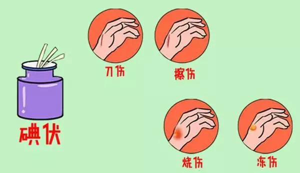 紫药水、红药水、酒精、碘伏……哪种处理伤口好？你可能一直都用错了