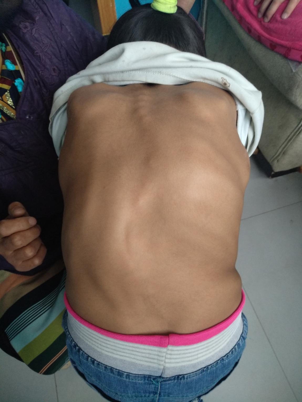 骨科专家帮扶,骨科下乡帮扶预期目标