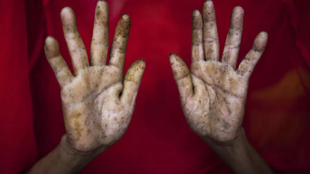 是毒还是药？毒死光绪的鹤顶红，也是白血病患者的救命药