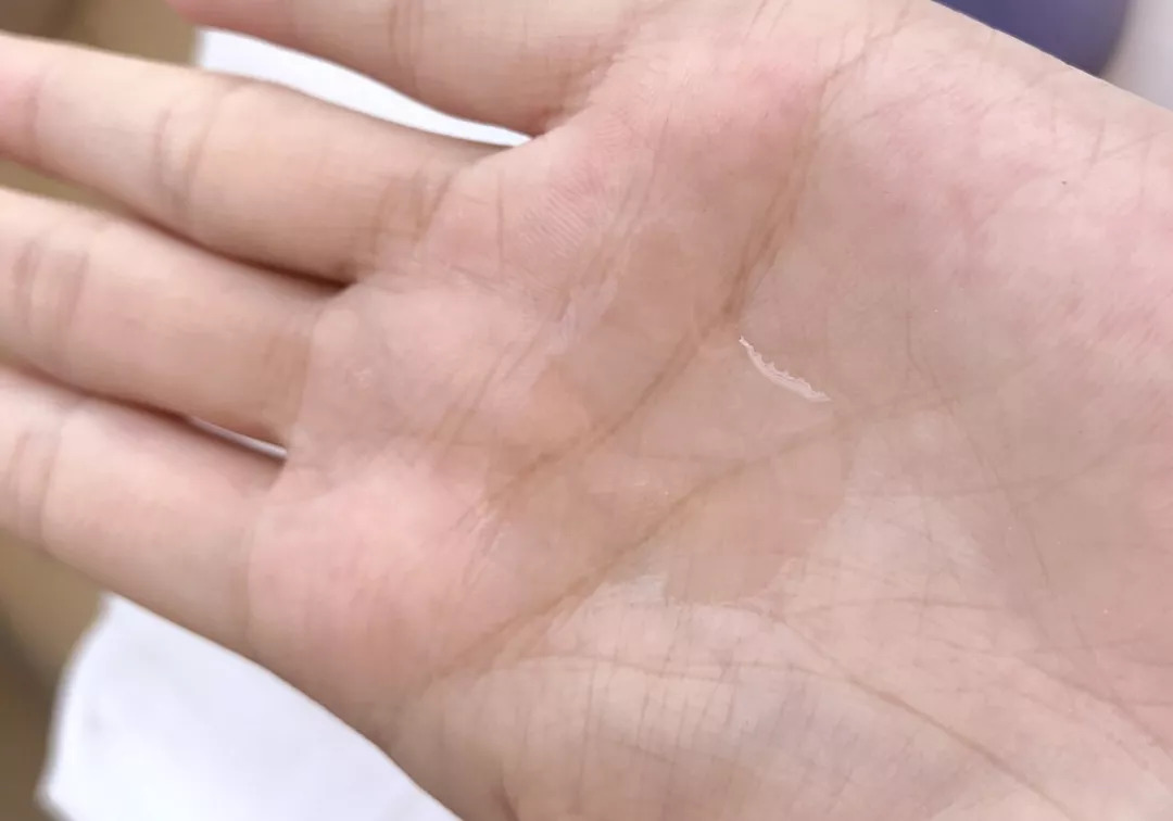 秋风皮肤干燥怎么护肤,秋风吹皮肤干燥