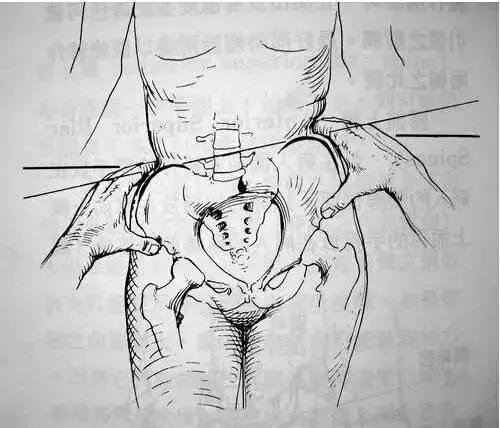 一个动作坚持一周就能把腿变直,万万没想到这个动作会毁了你的腰
