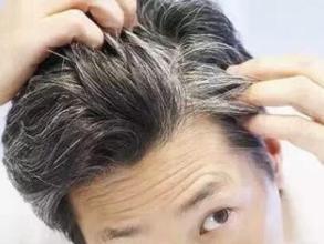 怎么样可以让白头发变黑,有什么办法能使白头发变黑