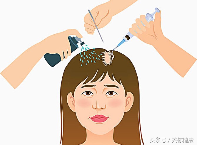 脱发医学治理,脱发最新药物研究突破