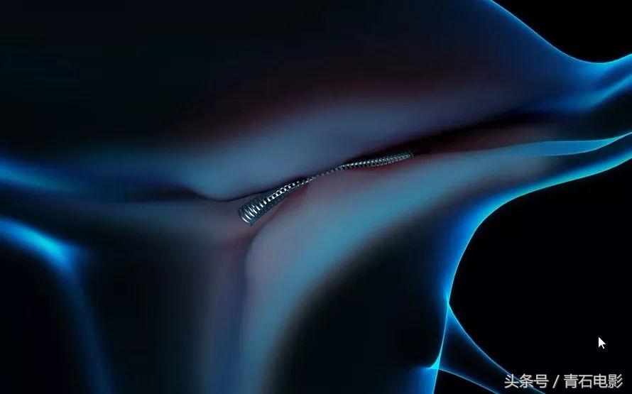 4公分线圈可避孕，护士曾为其代言，但纪录片上映后产品遭停售！