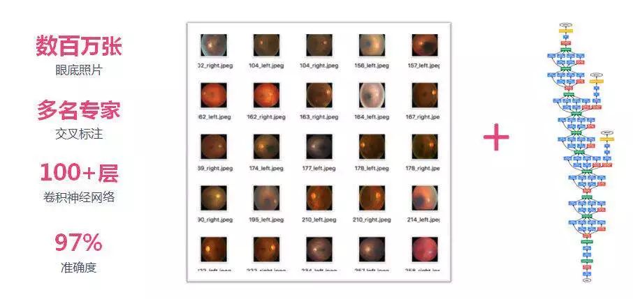 宝岛眼镜几折合适,宝岛眼镜什么时候活动最优惠