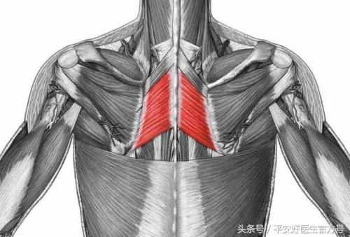 翼状肩胛骨矫正最快的方法,翼状蝴蝶骨矫正