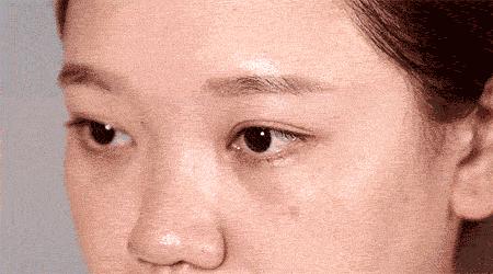 眼科医院如何治疗儿童近视,北京儿童医院眼科专家哪个好