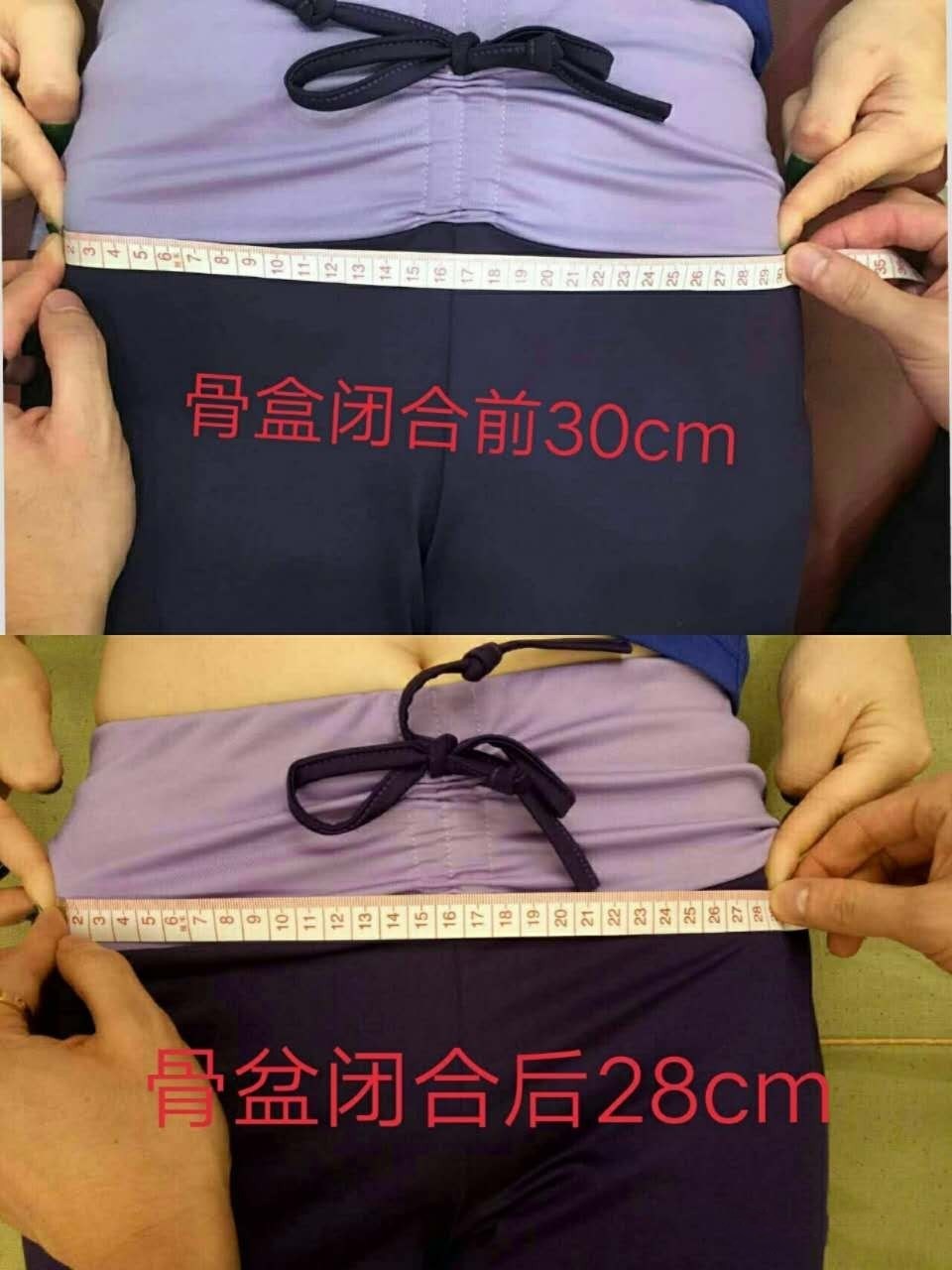 产后腰围能自动恢复吗,做了产后修复腰围少了3cm