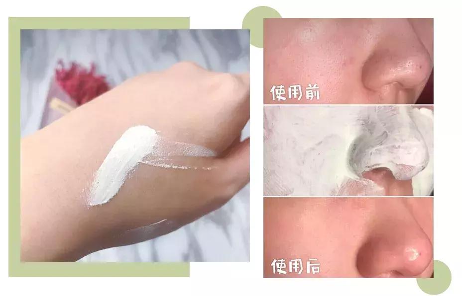 闊╅洩鑸掓穱,鑸掓穱闊╅洩