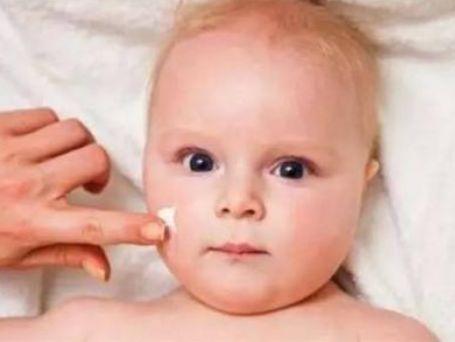 宝宝湿疹难缠,宝宝湿疹为什么反复发作该怎么办