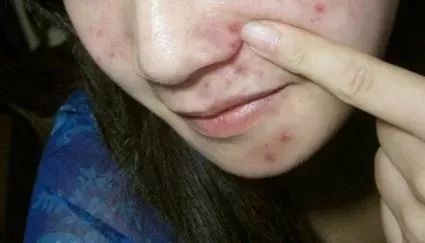 脸上污垢,脸上的脏东西真能清理出来吗