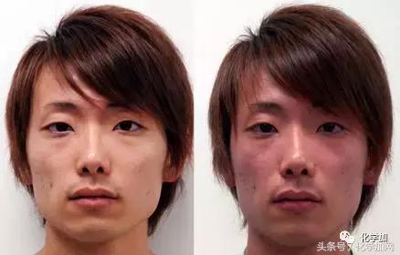 喝酒后皮肤变红逐渐变白是啥,喝酒后脸色会变白什么原因