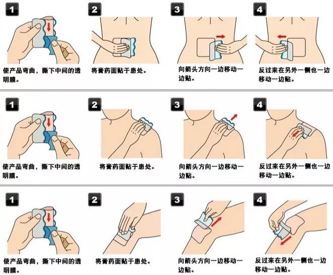 治疗关节炎的日本进口药,日本治疗创伤性关节炎