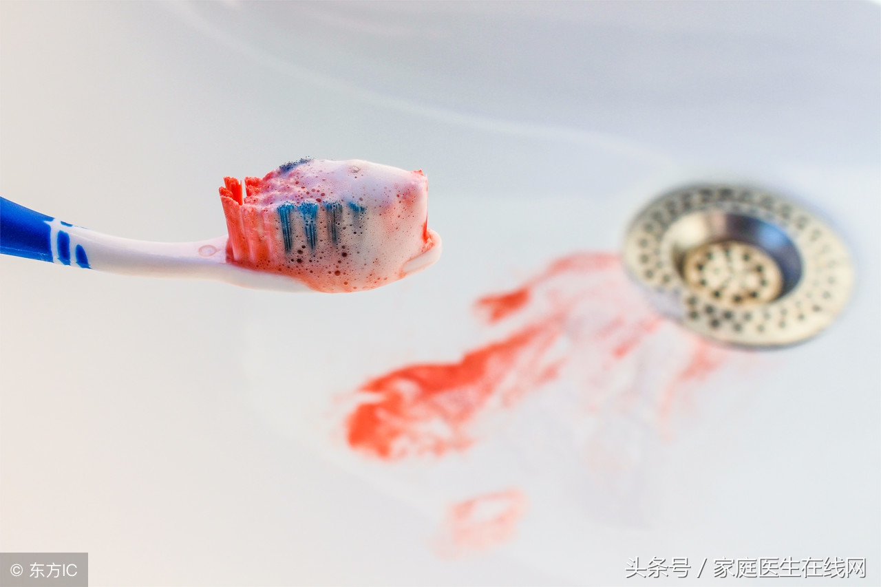 牙龈出血要警惕什么病,牙龈出血是大问题还是小问题