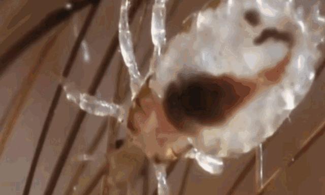 吃活物有寄生虫,吃活的虫子身体里有寄生虫