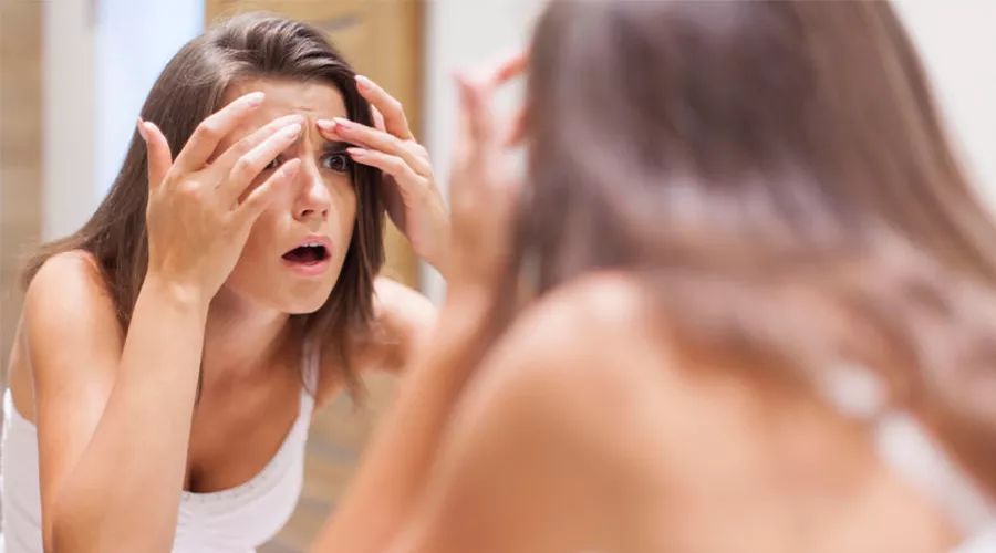 痘痘一直不好为哪般,痘痘一直不好应该怎么护肤