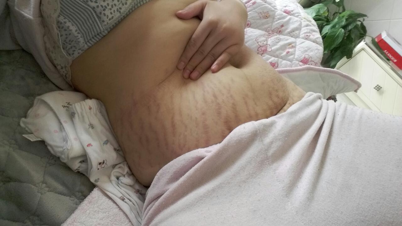 生完娃身材大变样遭嫌弃,生完孩子你被嫌弃了吗