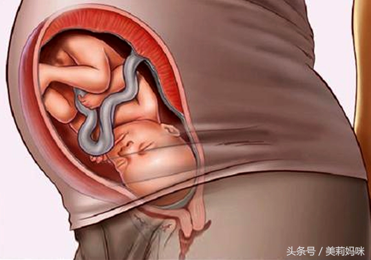 孕35周胎儿开始入盆了吗,孕35周怎么判断胎儿是否入盆